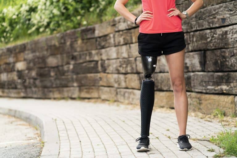 Smart Prosthetics – How 21st-Century Tech Increases Independence
